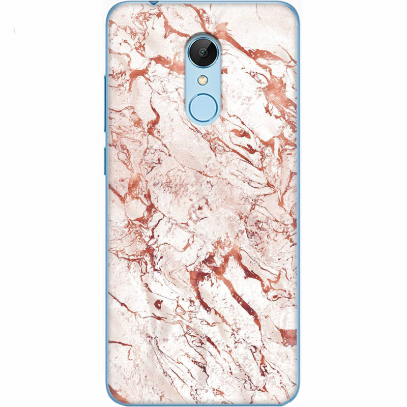 Чехол Uprint Xiaomi Redmi 5 
