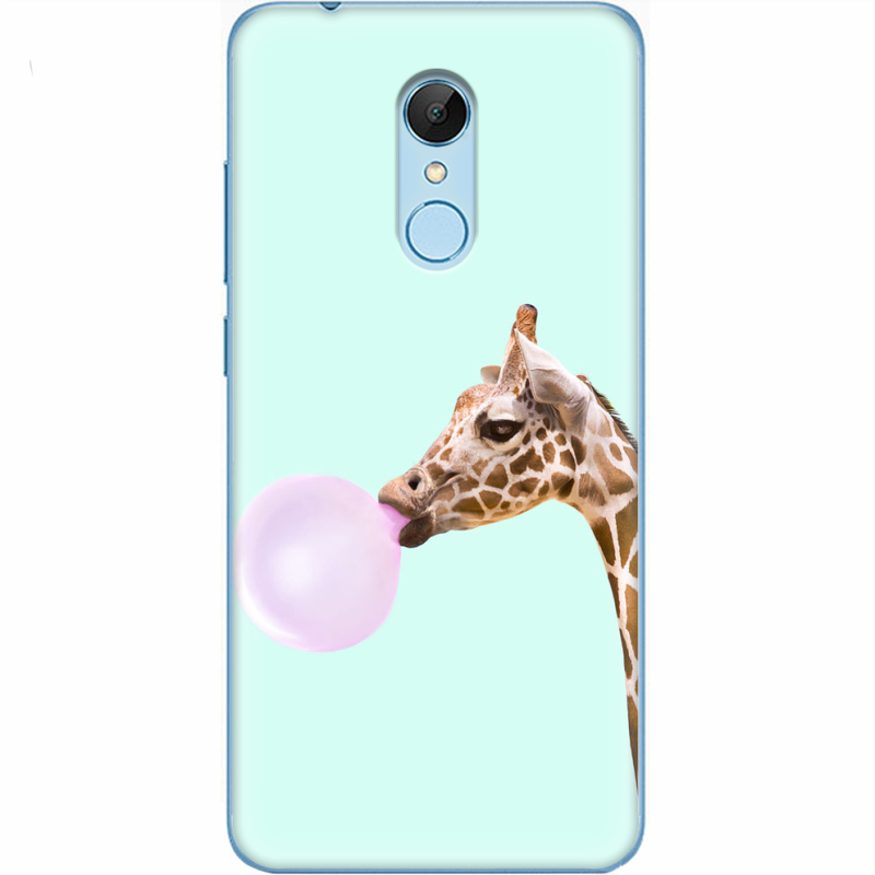 Чехол Uprint Xiaomi Redmi 5 
