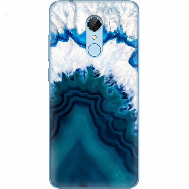 Чехол Uprint Xiaomi Redmi 5 