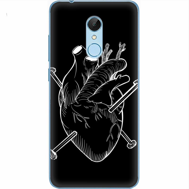 Чехол Uprint Xiaomi Redmi 5 