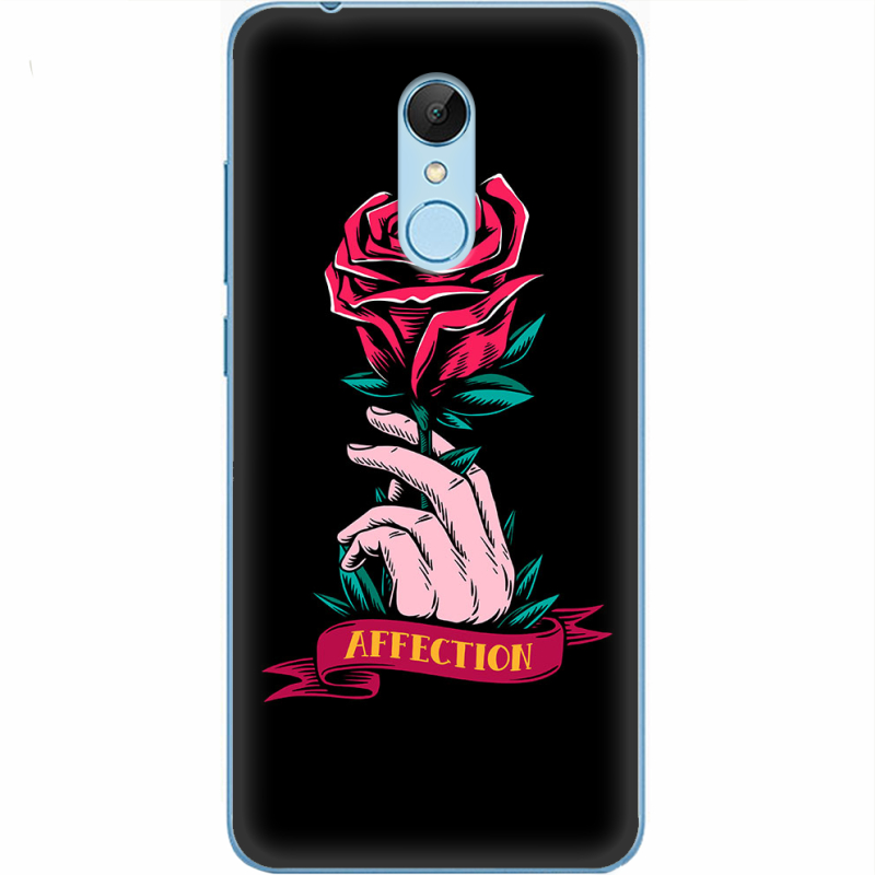 Чехол Uprint Xiaomi Redmi 5 