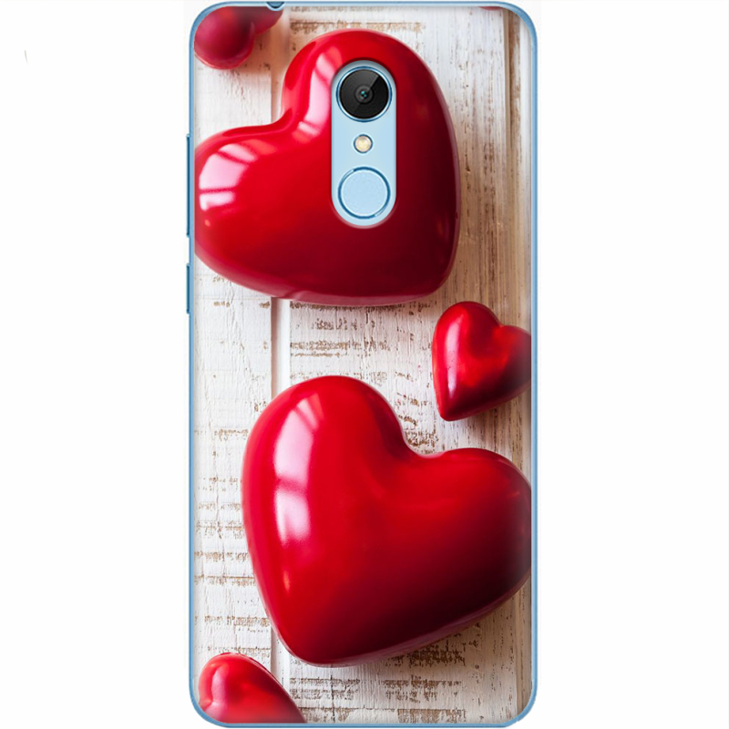 Чехол Uprint Xiaomi Redmi 5 