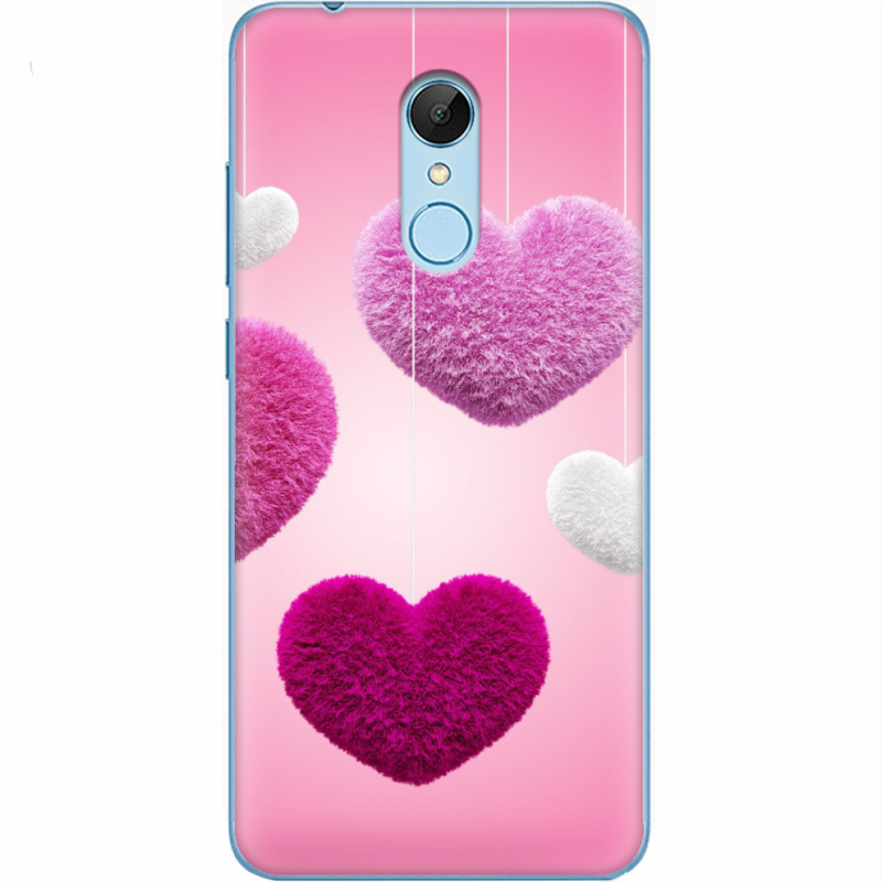 Чехол Uprint Xiaomi Redmi 5 