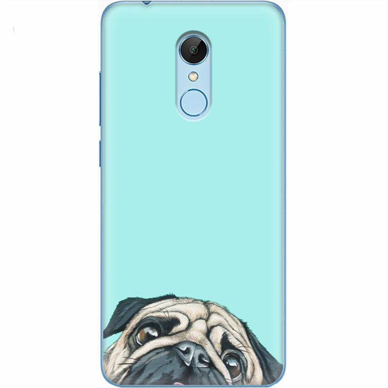 Чехол Uprint Xiaomi Redmi 5 