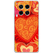 Чехол BoxFace Tecno Camon 30 Warm Hearts