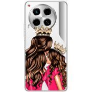 Прозрачный чехол BoxFace Tecno Camon 30 Queen and Princess