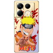 Прозрачный чехол BoxFace Infinix Note 40 4G Naruto