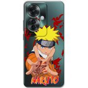 Прозрачный чехол BoxFace OPPO Reno 11 F Naruto