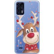 Прозрачный чехол BoxFace Oukitel C31 Winter Deer