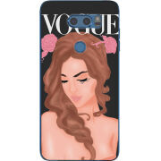 Чехол Uprint LG V30 / V30 Plus H930DS Fashion Girl