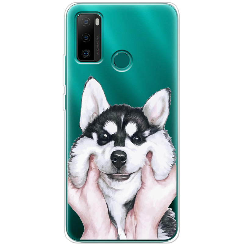 Прозрачный чехол BoxFace Ulefone Note 10P Husky