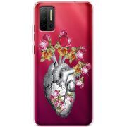 Чехол со стразами Ulefone Note 11P Heart