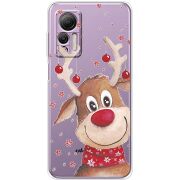 Прозрачный чехол BoxFace Ulefone Note 14 Winter Deer