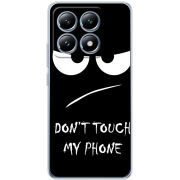 Чехол BoxFace Xiaomi 14T Don't Touch my Phone