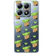 Прозрачный чехол BoxFace Xiaomi 14T Pattern Baby Yoda