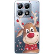 Прозрачный чехол BoxFace Xiaomi 14T Winter Deer