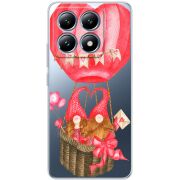 Прозрачный чехол BoxFace Xiaomi 14T Valentine Dwarfs