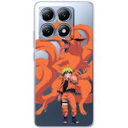 Прозрачный чехол BoxFace Xiaomi 14T Naruto and Kurama