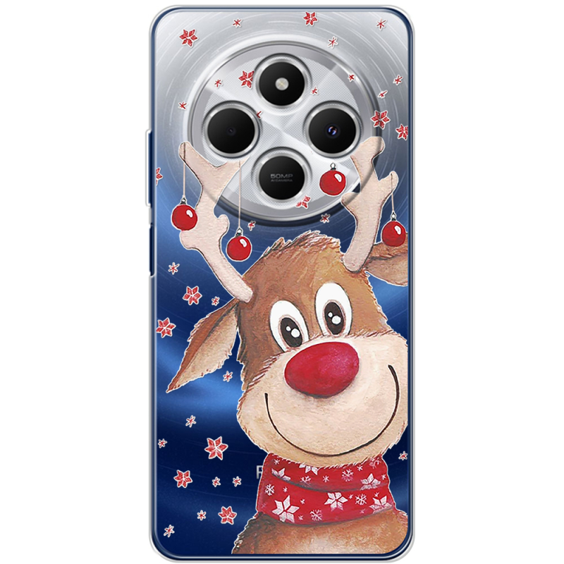 Прозрачный чехол BoxFace Xiaomi Redmi 14C Winter Deer