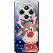 Прозрачный чехол BoxFace Xiaomi Redmi 14C Winter Deer