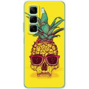 Чехол BoxFace Infinix Hot 50 Pineapple Skull