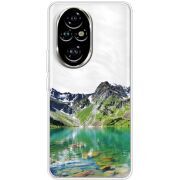 Прозорий чохол BoxFace Honor 200 Green Mountain