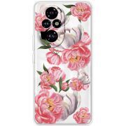 Прозорий чохол BoxFace Honor 200 Peony Watercolor Style