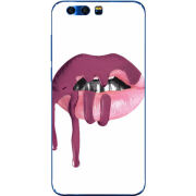 Чехол Uprint Huawei Honor 9 