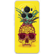 Чехол BoxFace Honor Magic 6 Pro Pineapple Skull