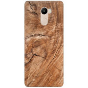 Чехол Uprint Xiaomi Redmi 4 / Redmi 4 Pro 