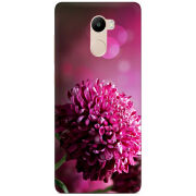 Чехол Uprint Xiaomi Redmi 4 / Redmi 4 Pro 