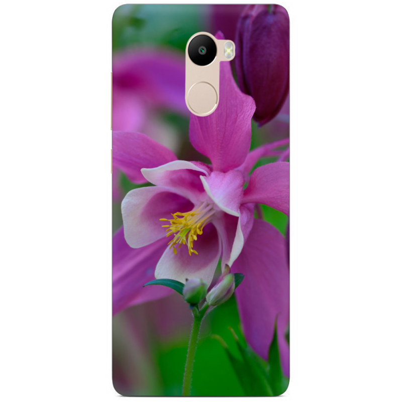 Чехол Uprint Xiaomi Redmi 4 / Redmi 4 Pro 