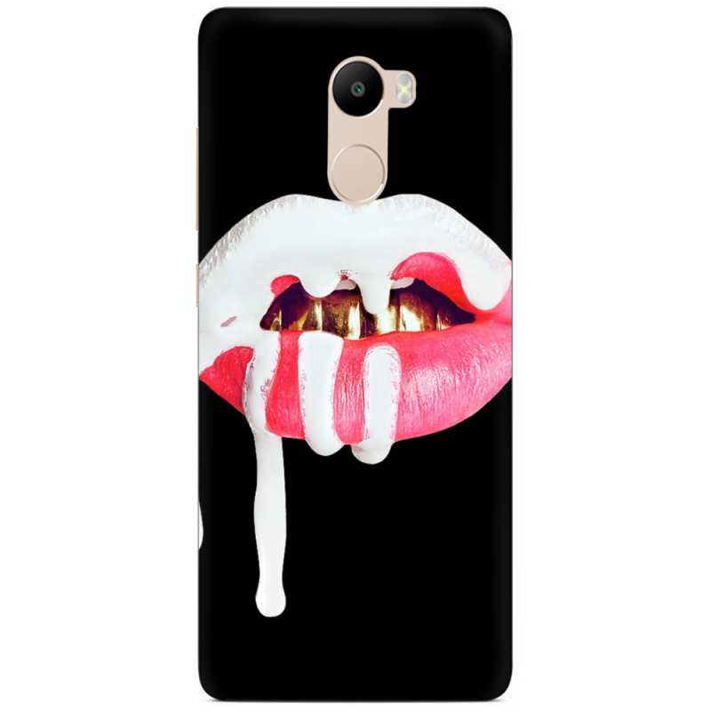 Чехол Uprint Xiaomi Redmi 4 / Redmi 4 Pro 