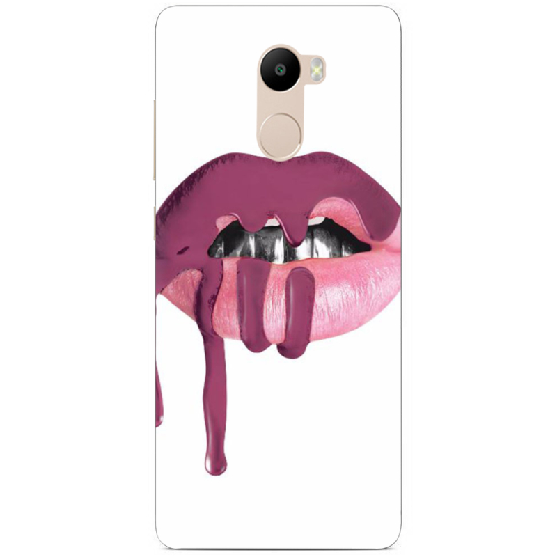 Чехол Uprint Xiaomi Redmi 4 / Redmi 4 Pro 