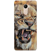 Чехол Uprint Xiaomi Redmi 4 / Redmi 4 Pro 