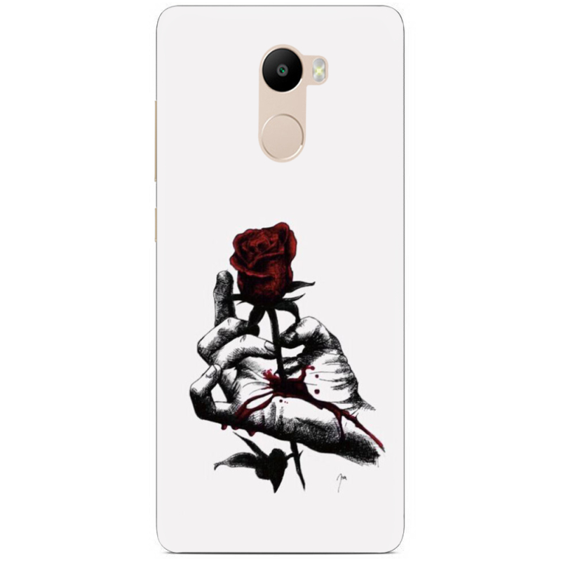 Чехол Uprint Xiaomi Redmi 4 / Redmi 4 Pro 