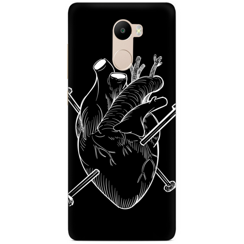 Чехол Uprint Xiaomi Redmi 4 / Redmi 4 Pro 