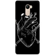 Чехол Uprint Xiaomi Redmi 4 / Redmi 4 Pro 