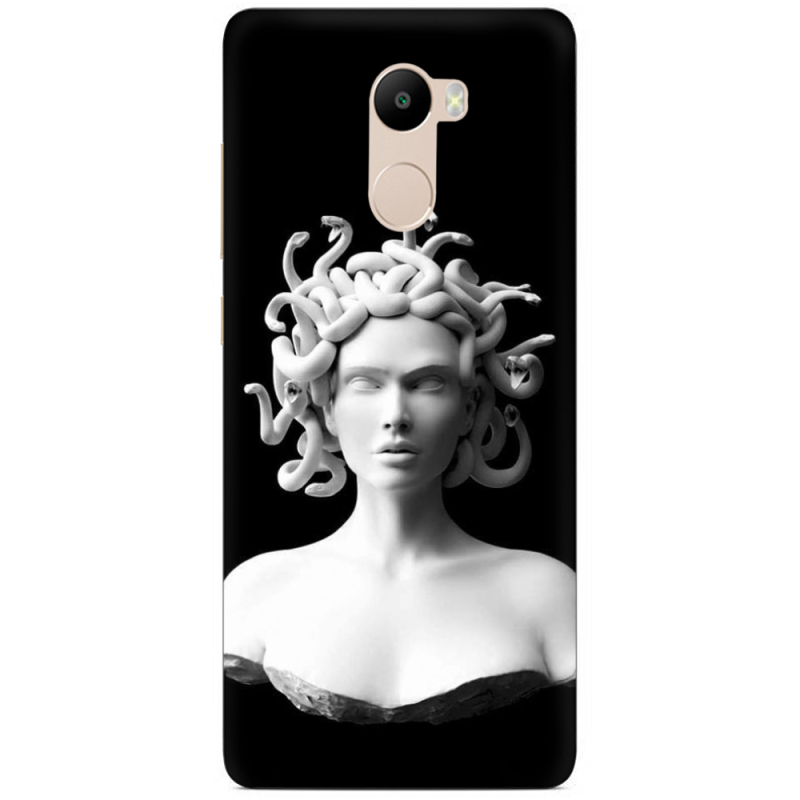 Чехол Uprint Xiaomi Redmi 4 / Redmi 4 Pro 