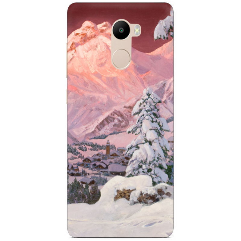 Чехол Uprint Xiaomi Redmi 4 / Redmi 4 Pro 