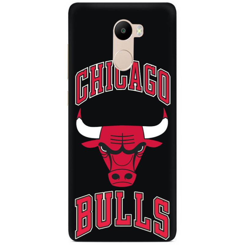 Чехол Uprint Xiaomi Redmi 4 / Redmi 4 Pro 