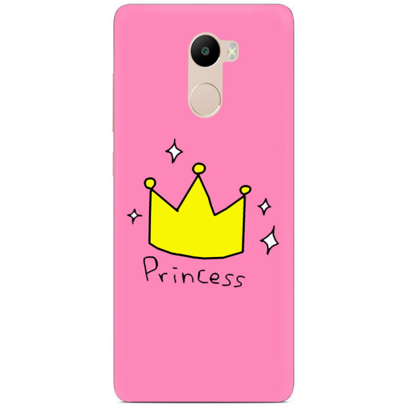 Чехол Uprint Xiaomi Redmi 4 / Redmi 4 Pro 