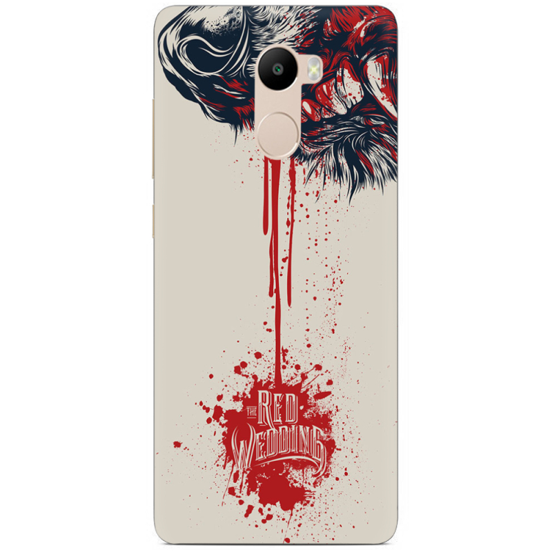 Чехол Uprint Xiaomi Redmi 4 / Redmi 4 Pro 