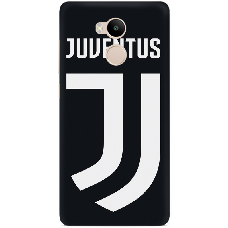 Чехол Uprint Xiaomi Redmi 4 Prime FC J