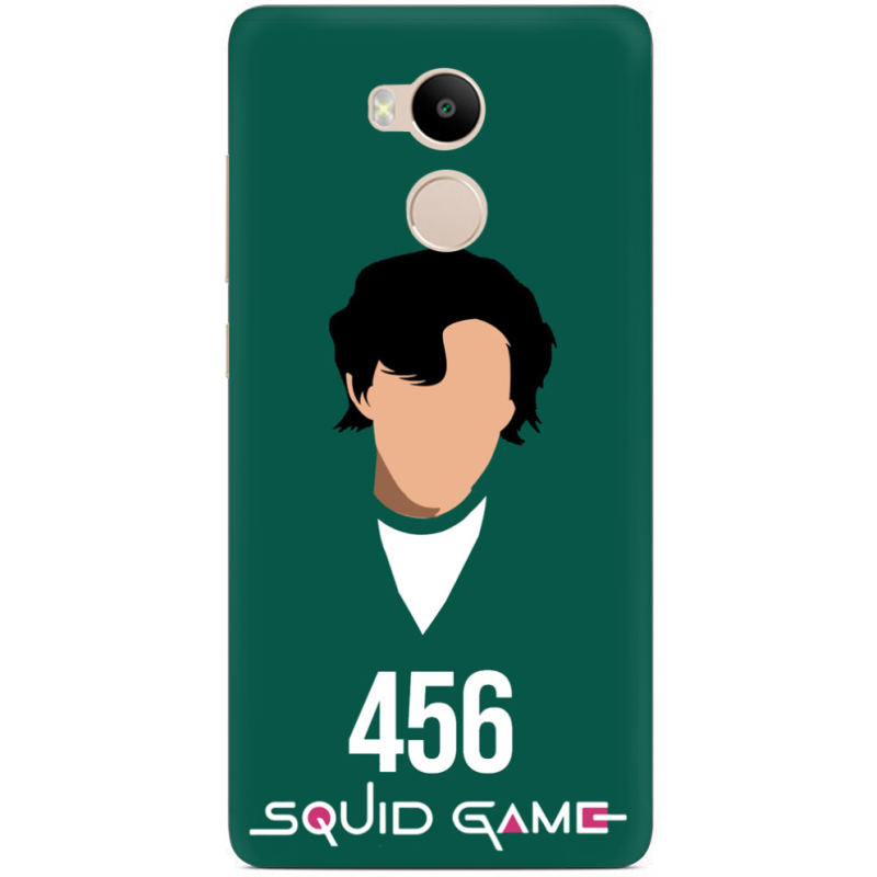 Чехол Uprint Xiaomi Redmi 4 Prime siquid game 456