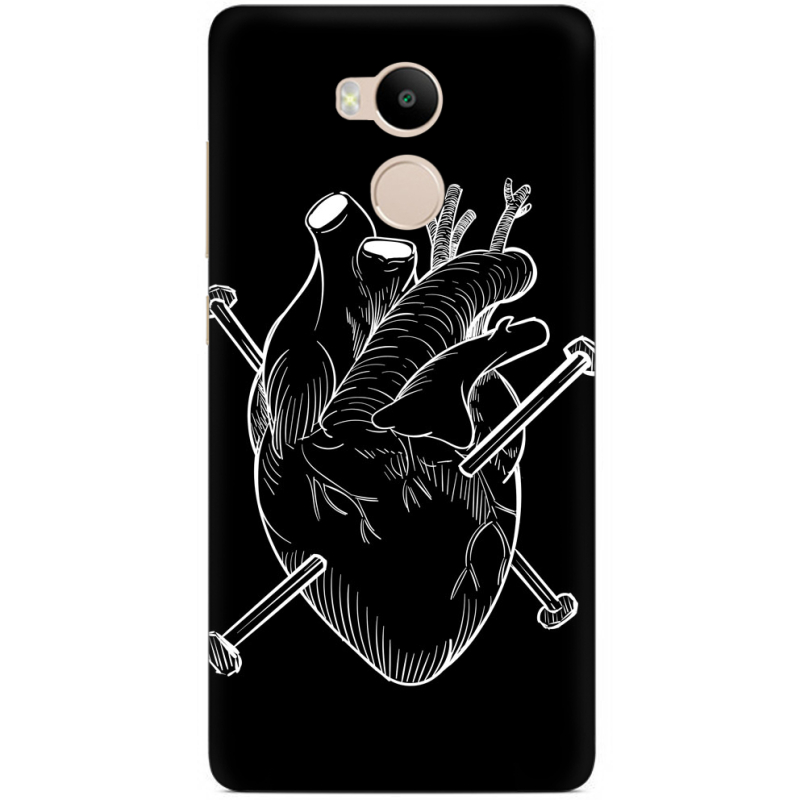 Чехол Uprint Xiaomi Redmi 4 Prime 