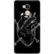 Чехол Uprint Xiaomi Redmi 4 Prime 