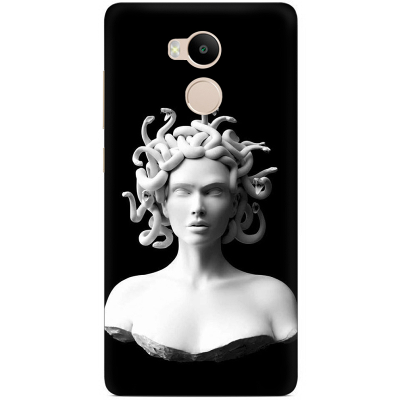 Чехол Uprint Xiaomi Redmi 4 Prime 