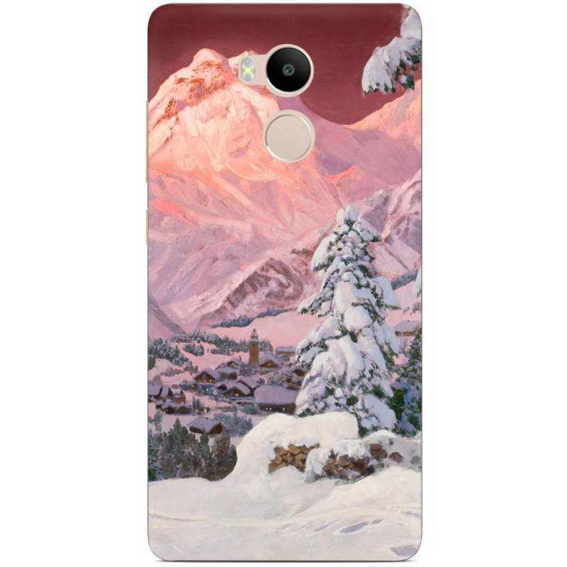 Чехол Uprint Xiaomi Redmi 4 Prime 