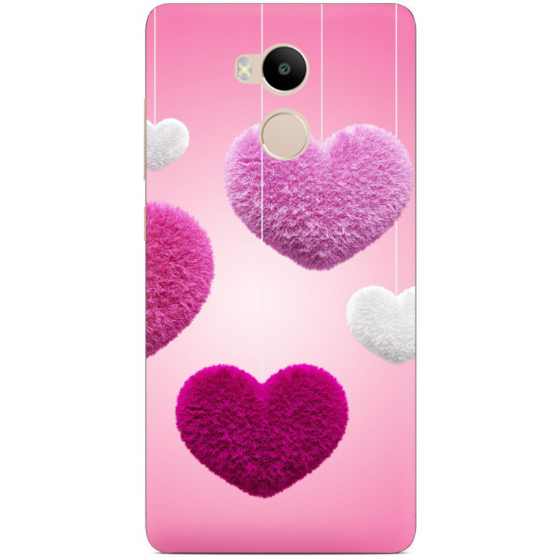 Чехол Uprint Xiaomi Redmi 4 Prime 